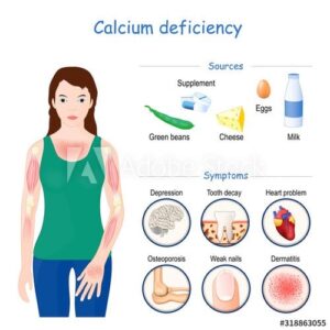 Read more about the article The Importance of Calcium for Women’s Health